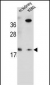 RN185 Antibody  (Center)